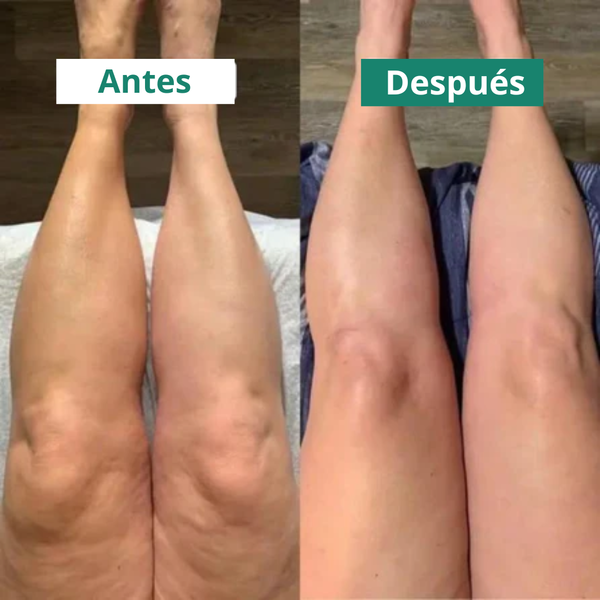 Complejo Linfático 6 en 1 