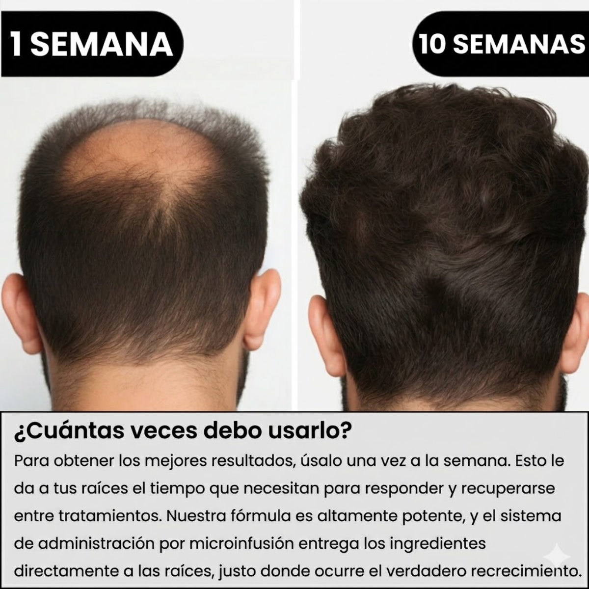 Capilux® InfusiónCapilar Pro Regenerador de Cabello
