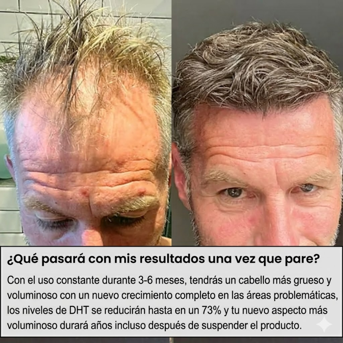 Capilux® InfusiónCapilar Pro Regenerador de Cabello