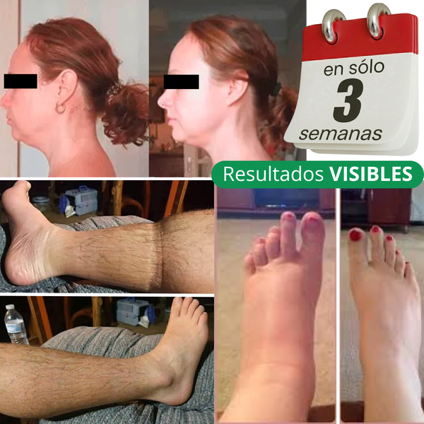 Lynae Drenaje Natural