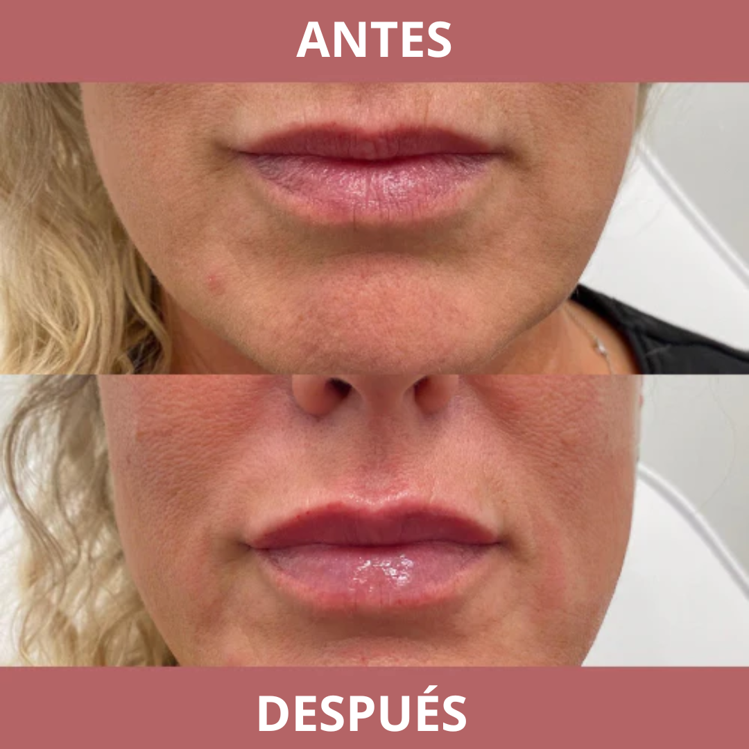 Biontauris GlowPump Lips - Volumen Labios Instantáneo