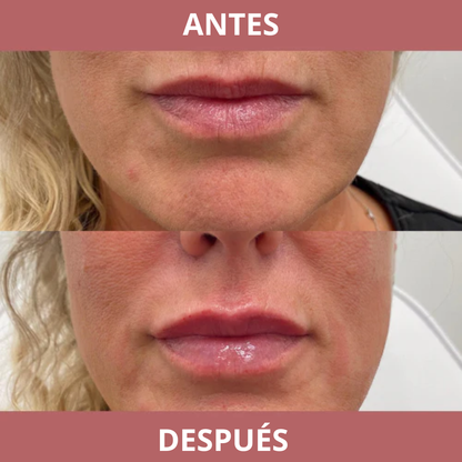 Biontauris GlowPump Lips - Volumen Labios Instantáneo