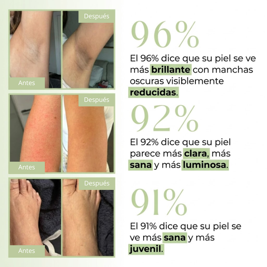 Bionaturis Spray Cúrcuma+Kójico - Eliminador manchas de la Piel