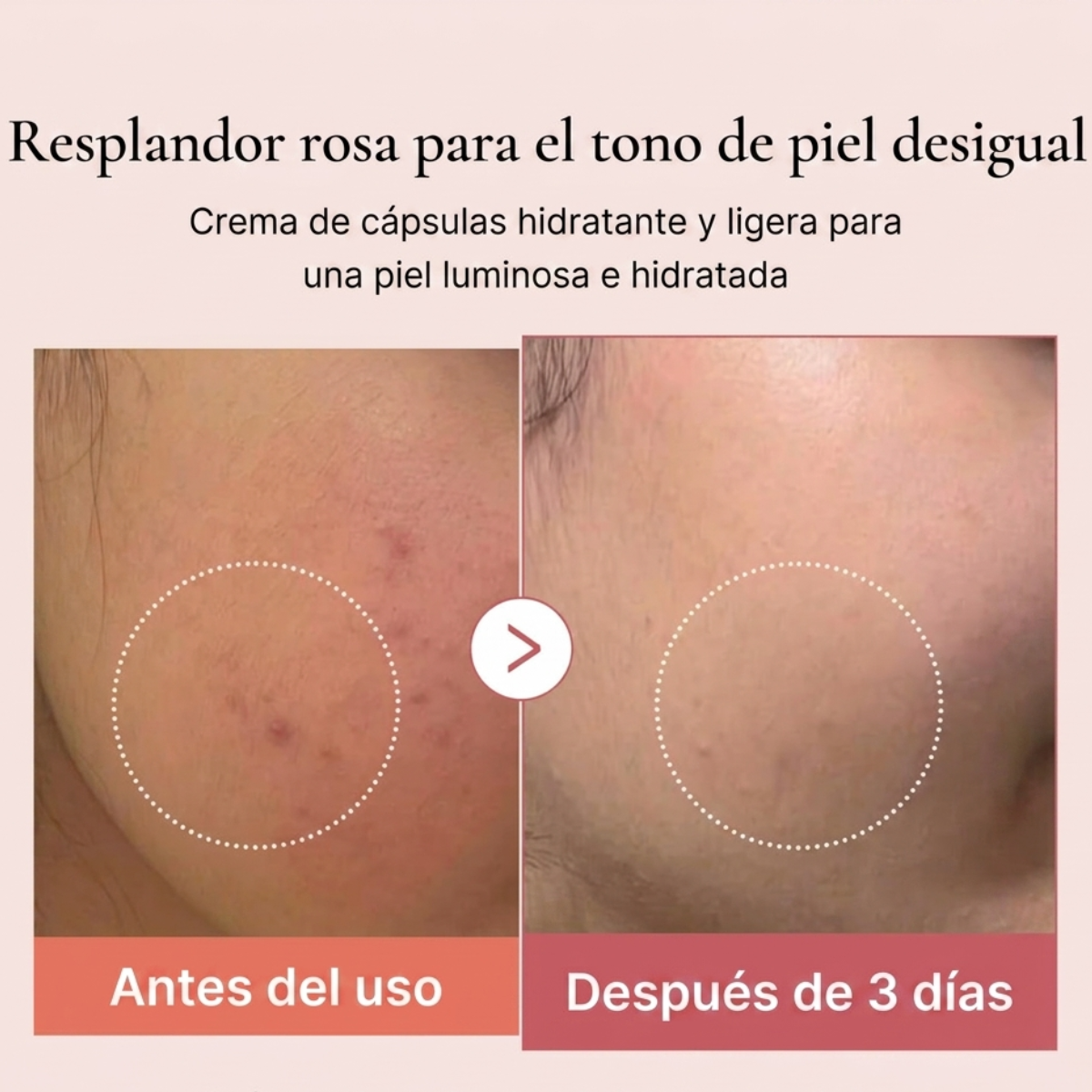 Set Coreano Medicure -Quita Arrugas y Manchas+Colágeno+Vit C