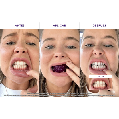 SmartWhite Pro I Dientes Blancos en 30 min