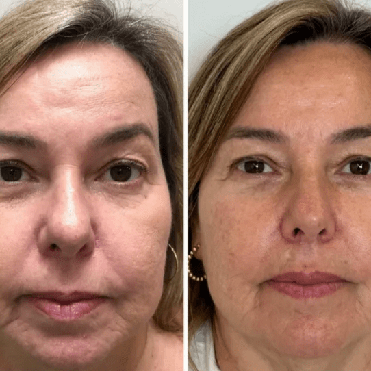 Mascarilla Coreana Real Collagen Peel-Off — Piel de Cristal desde Casa
