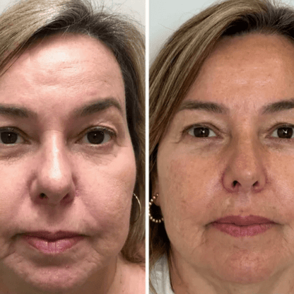 Mascarilla Coreana Real Collagen Peel-Off — Piel de Cristal desde Casa