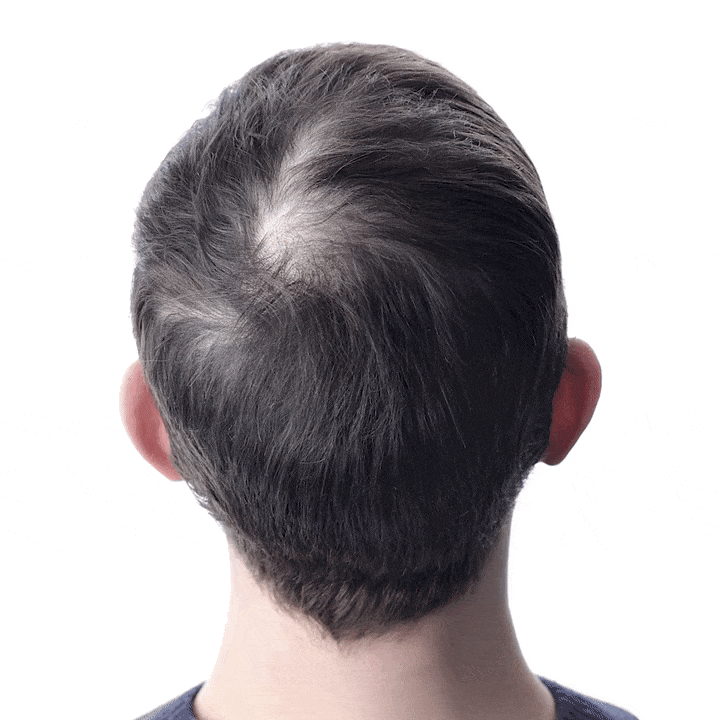 Capilux® InfusiónCapilar Pro Regenerador de Cabello