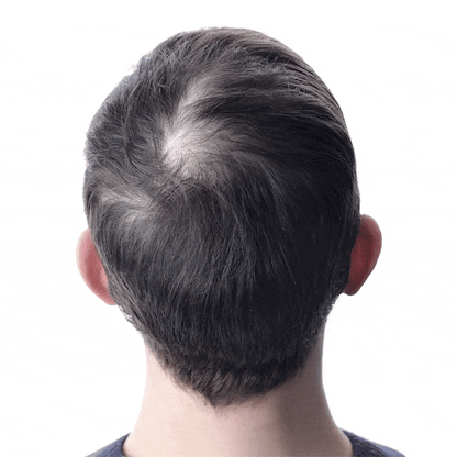 Capilux® InfusiónCapilar Pro Regenerador de Cabello