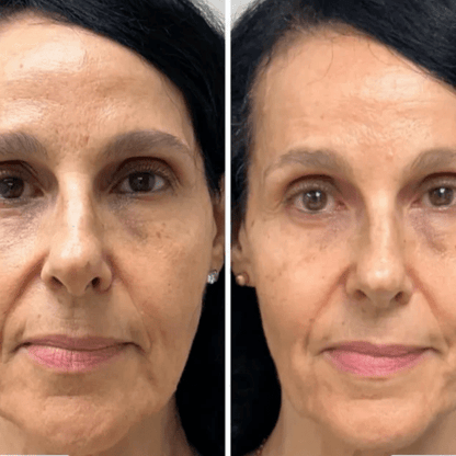Mascarilla Coreana Real Collagen Peel-Off — Piel de Cristal desde Casa