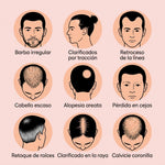 RootFix - Raíz cubierta En 10 Segundos